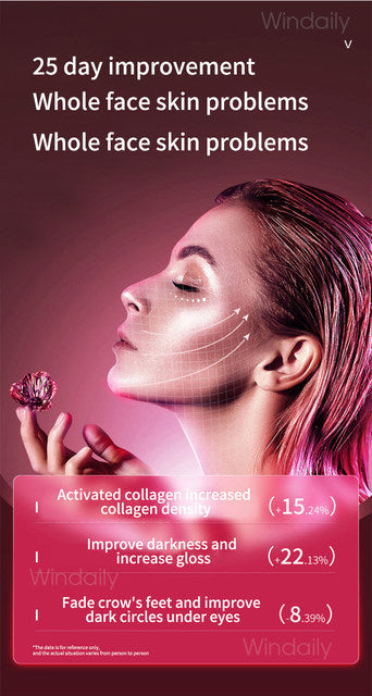 Facial Lifting Device LED Photon Therapy Facial Slimming Vibration Massager Double Chin V Face Shaped Cheek Lift Belt Machine - TimelessGear9