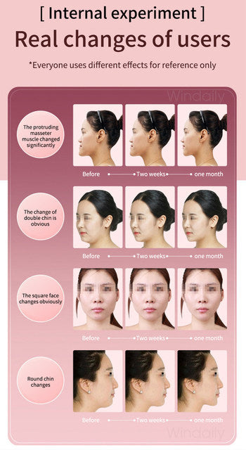 Facial Lifting Device LED Photon Therapy Facial Slimming Vibration Massager Double Chin V Face Shaped Cheek Lift Belt Machine - TimelessGear9